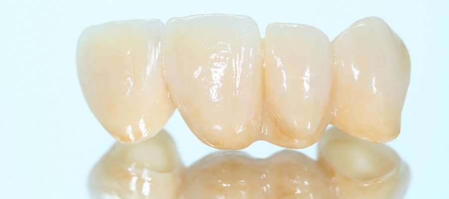 Crown & Bridge& Fixed and removable dentures